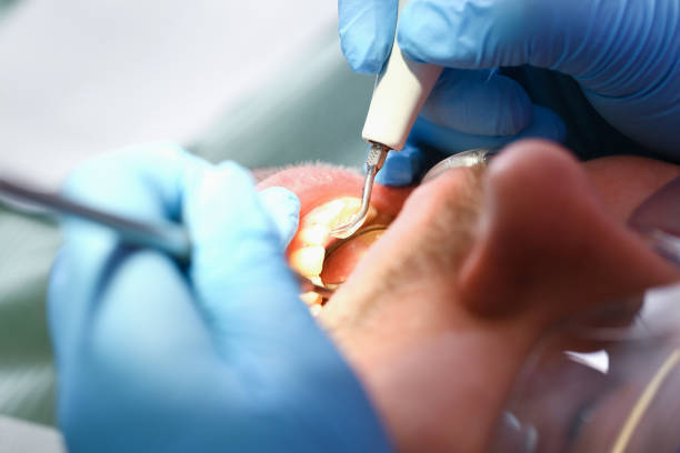 Best Walk-In Emergency Dentist in Hernando, FL