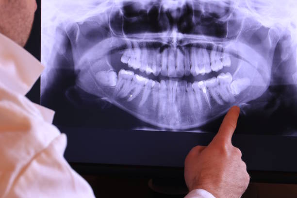 Best Same-Day Emergency Dentist in Hernando, FL
