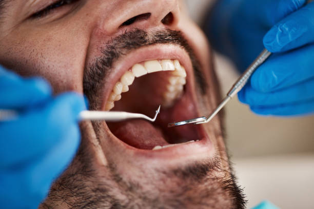 Best Emergency Tooth Extraction in Hernando, FL